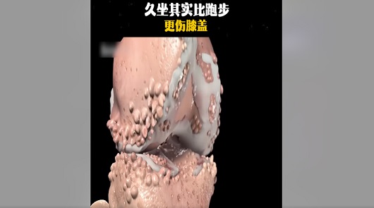 久坐其實比跑步更傷膝蓋